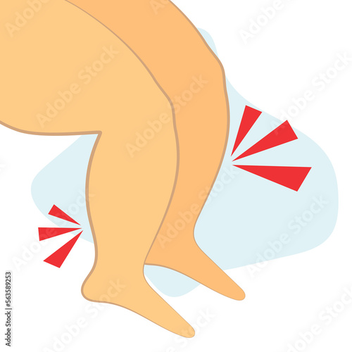 Owerweight woman's swelling legs in pain. Vector illustration