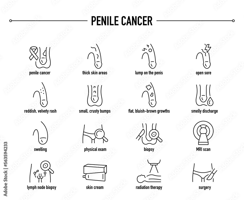 Penile Cancer symptoms, diagnostic and treatment vector icon set. Line editable medical icons. Penile Cancer symptoms, diagnostic and treatment vector icon set. Line editable medical icons.