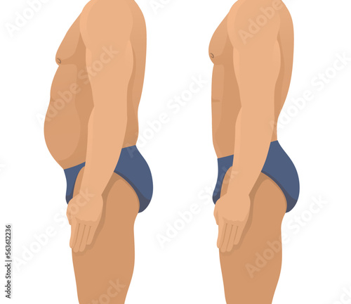 Vector illustration of a man's body with a fat belly and a man's body with a slender beautiful figure, before and after exercise for weight loss