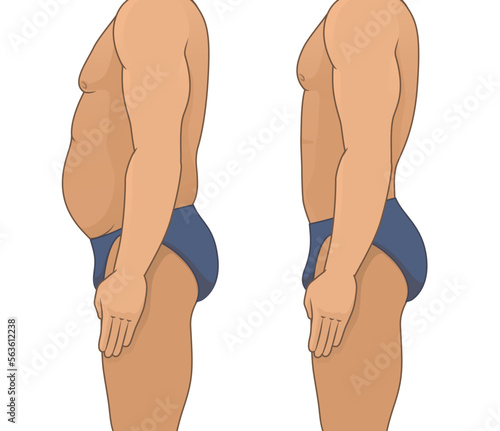 Vector illustration of a man's body with a fat belly and a man's body with a slender beautiful figure, before and after exercise for weight loss with contour