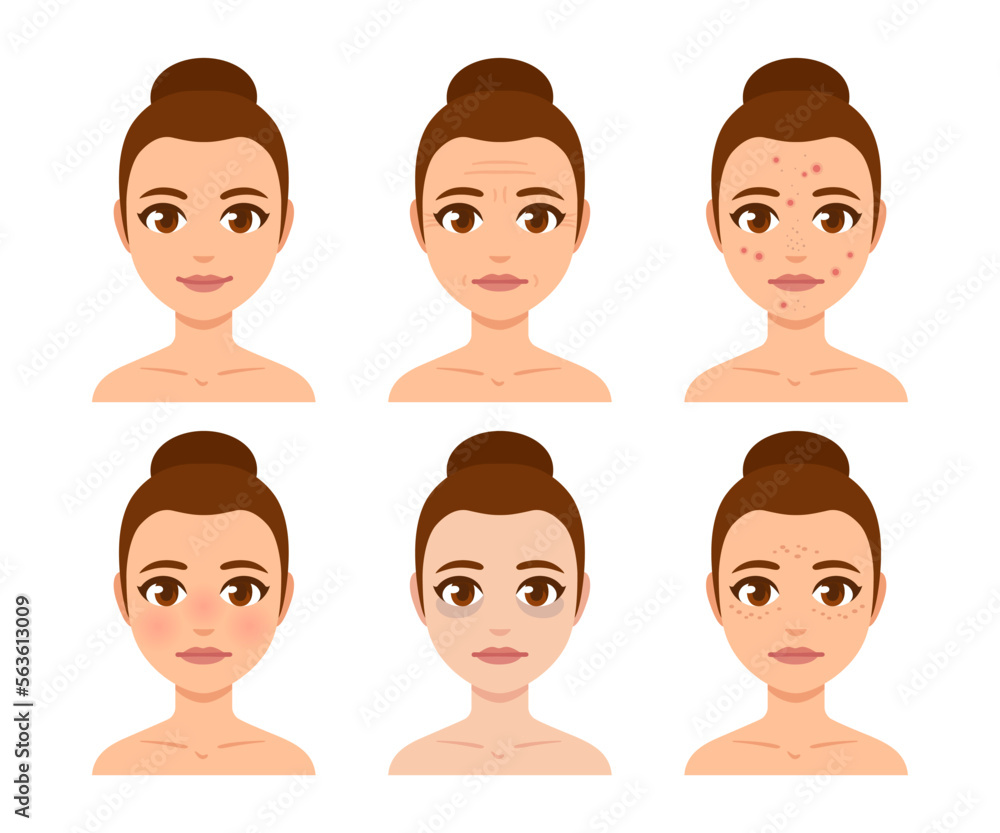 Skincare and skin concerns woman face set Skincare and skin concerns woman face set
