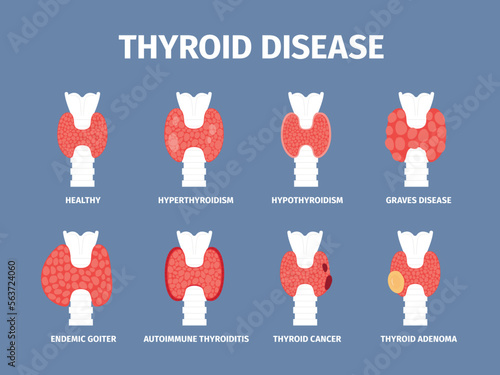Thyroid gland various diseases. Goiter and hyperthyroid, inflammation trachea icons. Endocrinology disease, cancer and thyroiditis, recent vector set