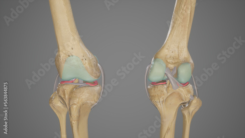 Anterior and Posterior View of Knee Joint with Removed Patella photo