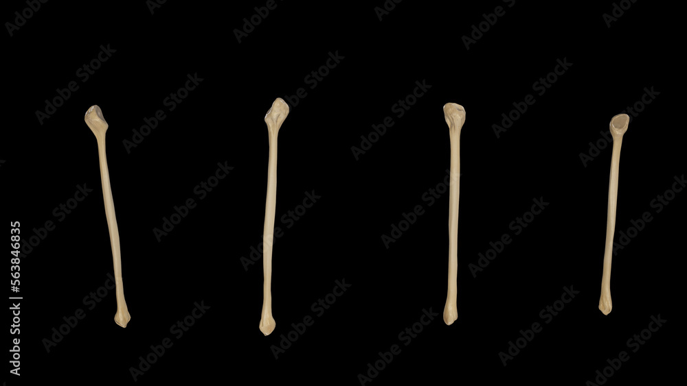 Right Fibula-Multiple Views Right Fibula-Multiple Views