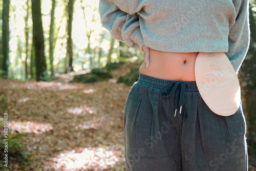 unrecognizable girl showing a ostomy bag. Confidence and recovery with a colon cancer