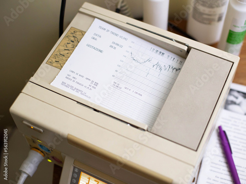 A medical device that conducts fetal cardiotocography in pregnant girls. Deciphering and frequency of seismicity in a child. photo