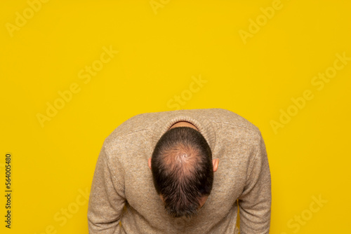 Caucasian man in a beige sweater leaning forward to show the camera his incipient alopecia, isolated on yellow background. photo