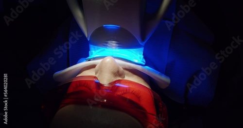 Teeth whitening at the dentist's office. Teeth whitening procedure with ultraviolet light UV lamp in a modern clinic. Whitening light bleaching woman teeth. Cosmetic dentistry center service. photo