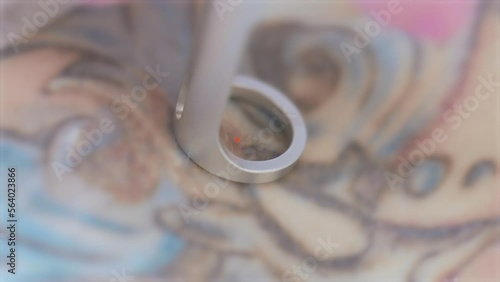 cosmetologist removes a tattoo to a patient using a neodymium laser in a modern clinic