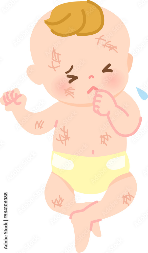 肌荒れしている赤ちゃんのイラスト素材_全身