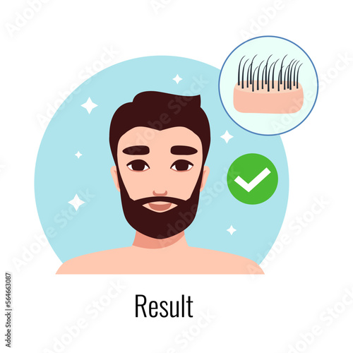 Male Alopecia Result Composition