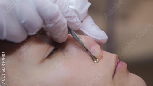 Super closeup of a Caucasian woman's nose receiving blackhead removal treatment photo