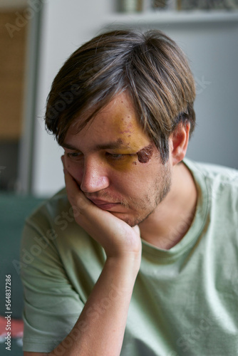 thoughtful man with a head injury photo
