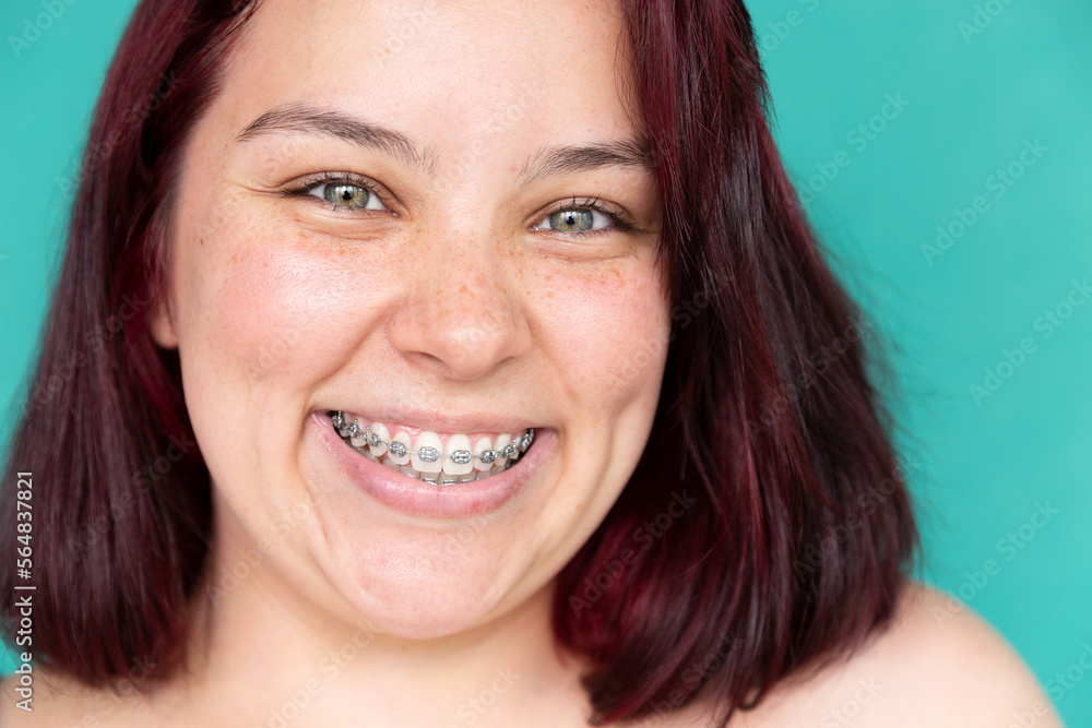 Portrait of a woman with an expressive smile and freckles Portrait of a woman with an expressive smile and freckles