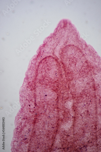 Clonorchis sinensis adults micrograph photo