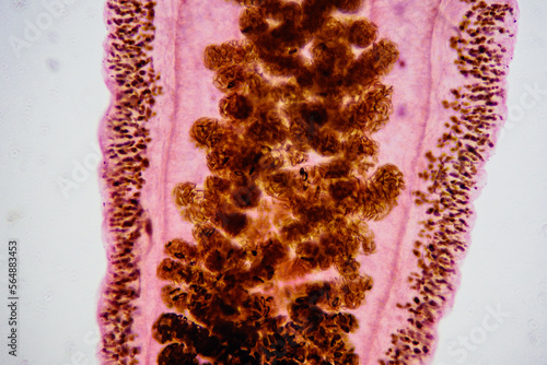 uterus of Clonorchis sinensis adults micrograph photo