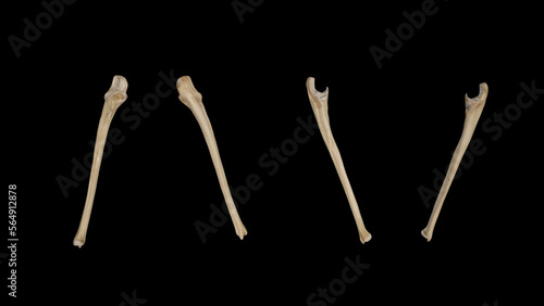 Right Ulna-Multiple Views