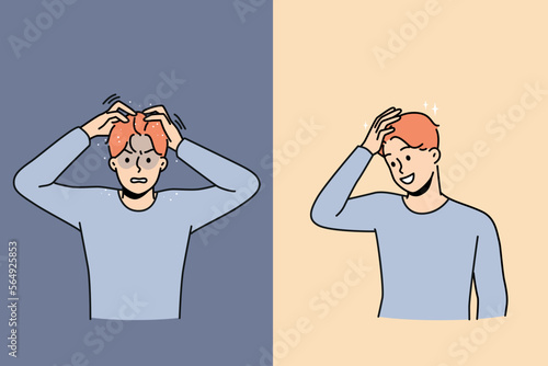 Set of young man suffer from dandruff versus excited with clean healthy hair after treatment. Concept of medical or beauty procedures for haircare. Vector illustration. 