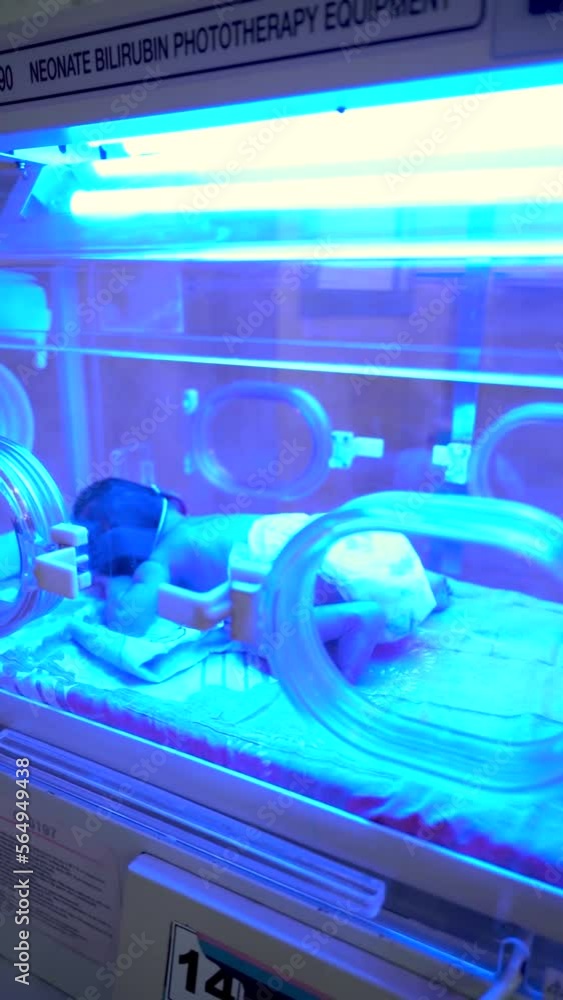 Vidéo Stock Newborn having a treatment for jaundice under ultraviolet
