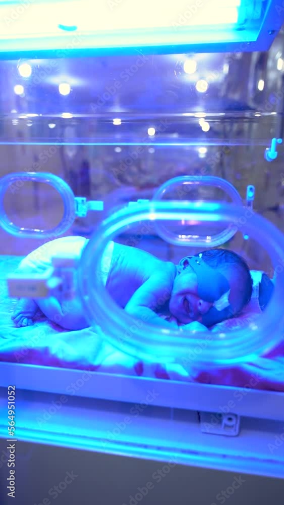 Vidéo Stock Newborn having a treatment for jaundice under ultraviolet