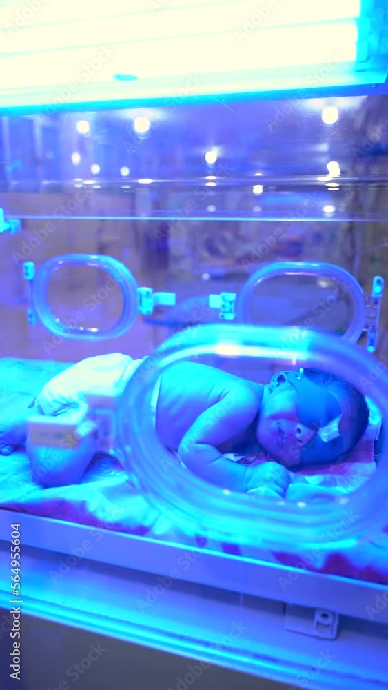 newborn-having-a-treatment-for-jaundice-under-ultraviolet-light-baby