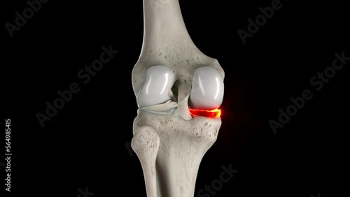 3D rendered medical animation of the medial meniscus photo