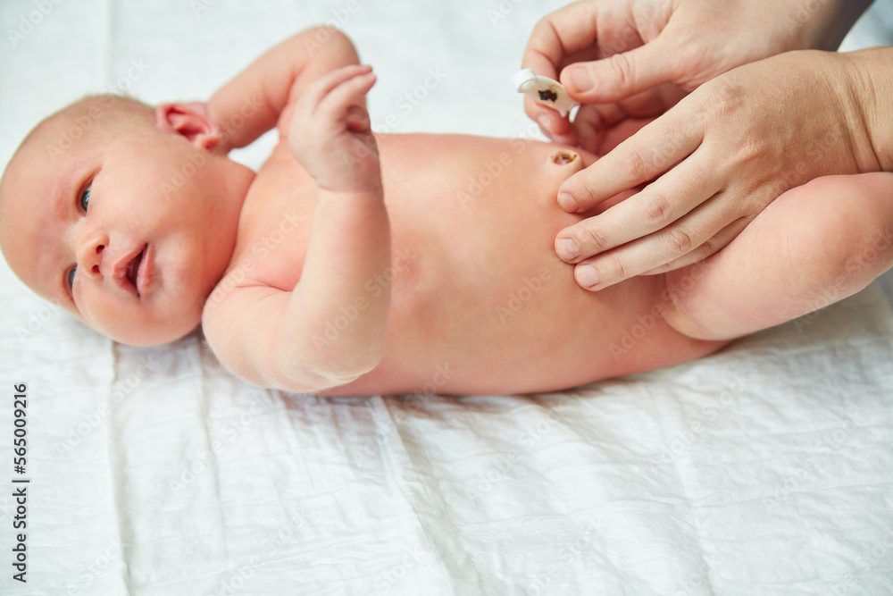 Mom treats the umbilical wound to a newborn baby. Mom treats the umbilical wound to a newborn baby.
