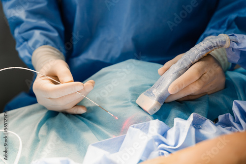 Fotografie Endovenous laser coagulation for treatment varicose veins and ultrasound machine