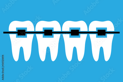 Tooth braces. Even white healthy teeth in braces. Flat icon on a blue background