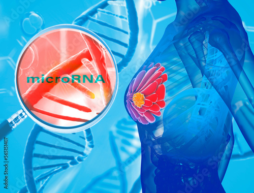 Breast cancer, new targeted therapy. microRNA (miR-182-3p) inhibits the telomeric protein TRF2, responsible for tumor	