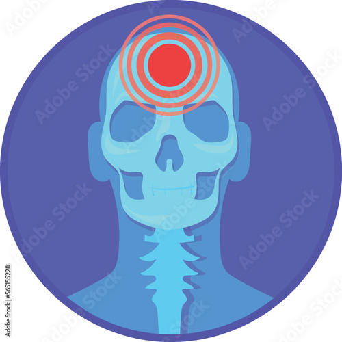 Headache round icon. Migraine symbol. Head pain