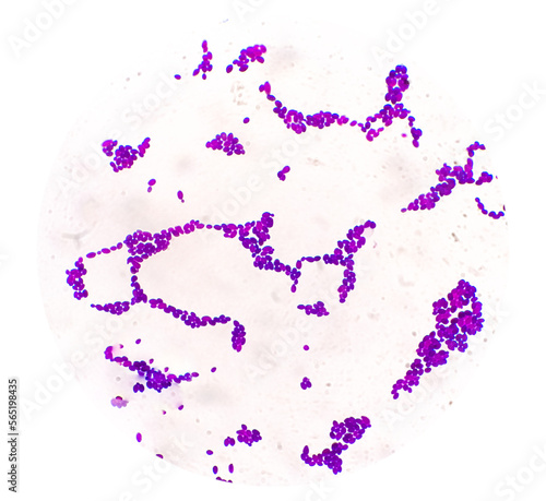 Obraz na plátne Candida Spp colony under microscopic view