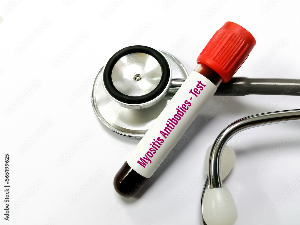 Myositis Antibodies blood test for the diagnosis of myositis diseases