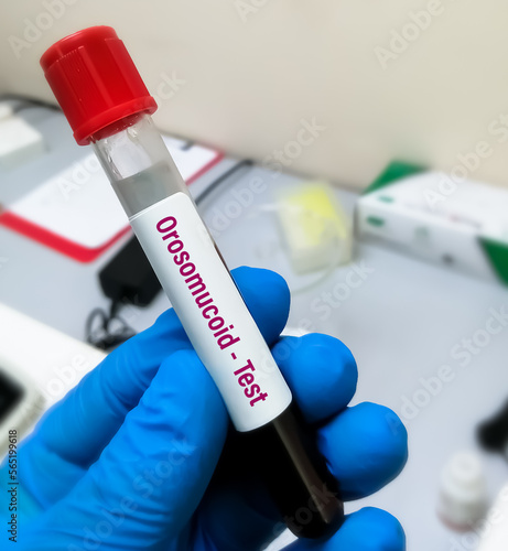 Blood sample for Orosomucoid or Alpha-1 acid glycoprotein test. photo