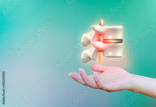 Spinal herniation, herniated disc. Low back pain. Spine. Intense disc pain. The hand holds the vertebrae on emerald green background. Chiropractic. Modern digital health care photo