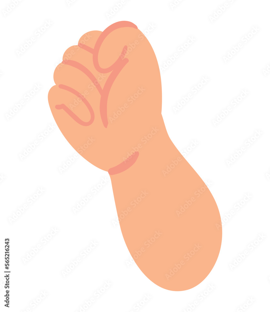 raised hand down syndrome raised hand down syndrome