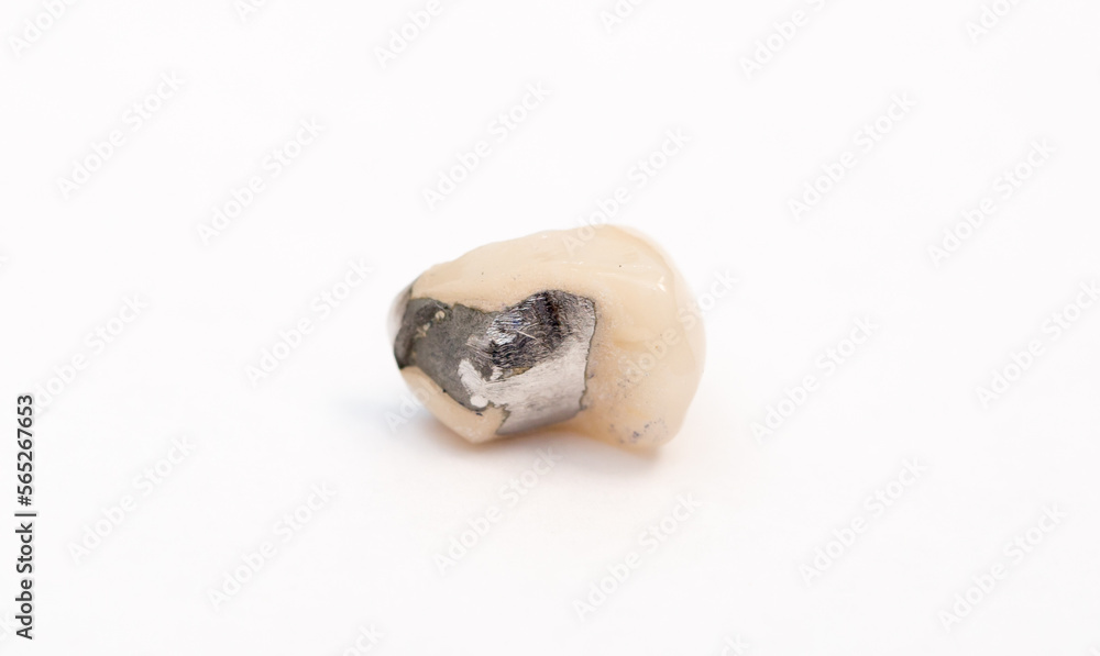 Human teeth on a white background, dentures teeth pulled out. Dentistry, orthodontist. Dentures. tooth loss