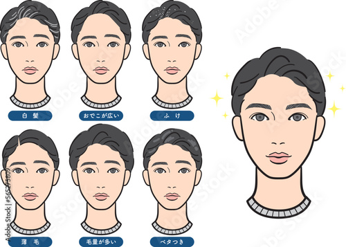 男性の髪の毛の悩みセット