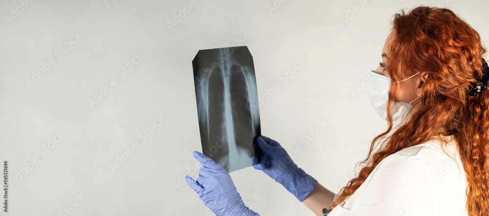 Foto de Radiography. A doctor examines a chest x-ray of a patient in a ...