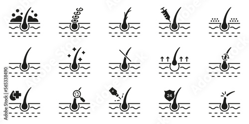 Healthy Dermatology Beauty Therapy for Epidermis Glyph Pictogram. Hair Loss, Growth, Transplant, Removal, Care Silhouette Black Icon Set. Hair Follicle Treatment Icon. Isolated Vector Illustration