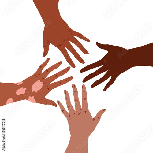 Group of hands reaching to each other, one hand with vitiligo patch