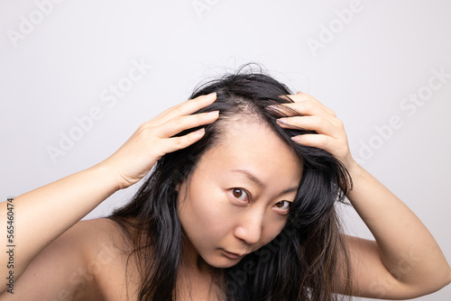 Asian woman serious hair loss problem for health care shampoo and beauty product concept