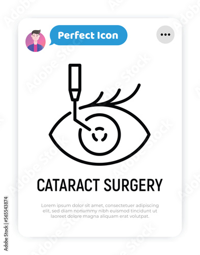 Cataract surgery thin line icon. Ophthalmology. Lasik vision correction. Modern vector illustration.