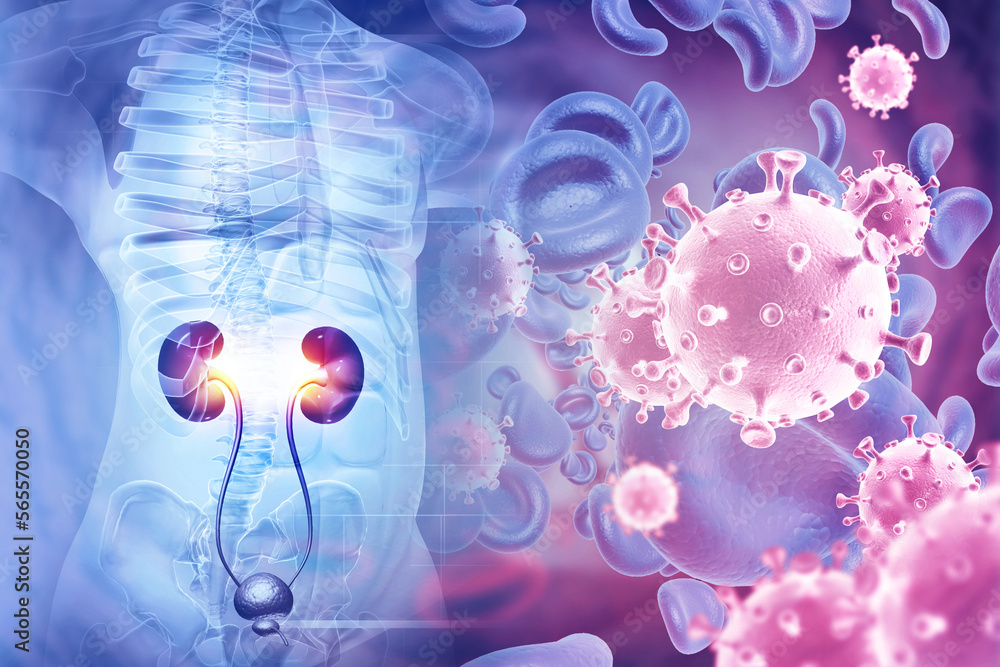 Human kidney medical diagram, anatomy of the kidney, diseased kidney