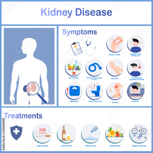 Infographics of various symptoms of kidney disease and treatments. Headache, insomnia, erectile dysfunction in males, edema and weight loss. Health care concept.vector illustration.flat style