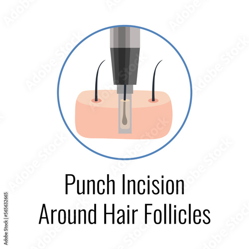 Alopecia Grafts Incision Composition