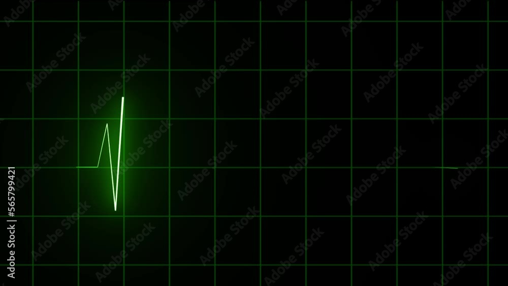 ecg heart beat on monitor | electrocardiogram  monitor effect | cardiology chat video
