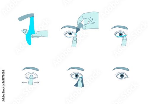 Cartoon Color Using Eye Drops Bottle Set Treatment Illness Ophthalmology Concept . Vector illustration of Eyedropper Applying
