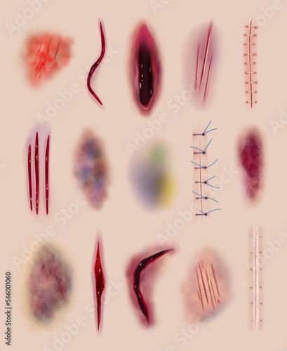 Bloody stitching. Cuts and wounds scars decent vector horror stiches in realistic style medicine templates