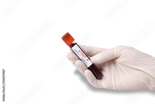 Blood collection tubes Group A Streptococcus test. strep A epidemic. photo